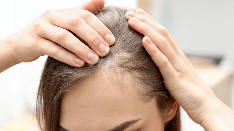 Rụng tóc thiếu chất gì? Nguyên nhân và cách giảm rụng tóc 1
