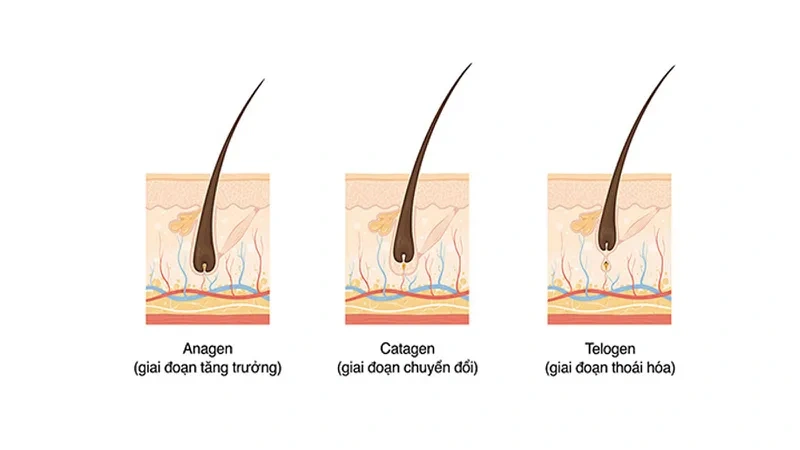 nguyên nhân rụng tóc ở nam