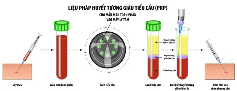 tại sao tóc rụng nhiều