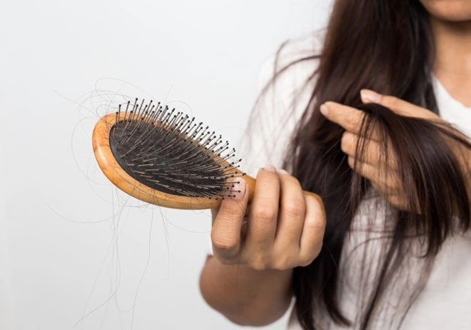 Tóc rụng nhiều phải làm sao? 4 cách giảm rụng tóc đơn giản tại nhà
