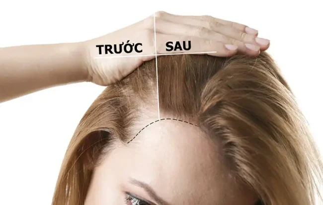 Cách để mọc tóc dài nhanh: 6 Bí quyết chăm tóc hiệu quả