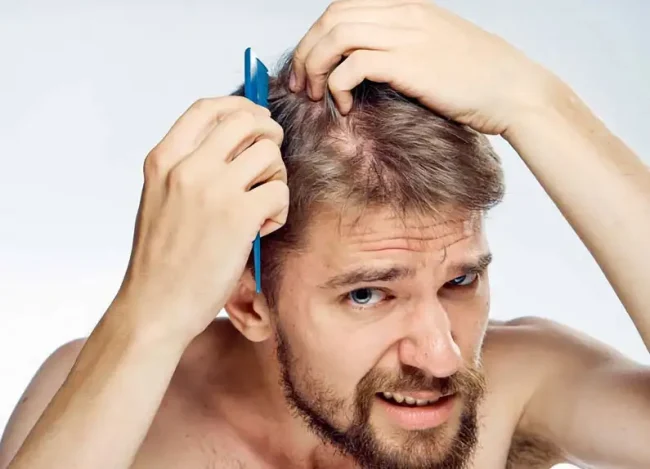 Dầu gội kích thích mọc tóc nam nên chọn loại nào?