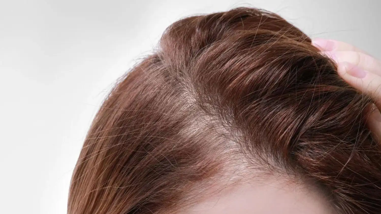 7 Cách hỗ trợ Kích Thích Mọc Tóc Nhanh Và Khỏe Từ Gốc