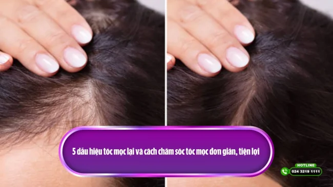 dấu hiệu tóc mọc dày trở lại