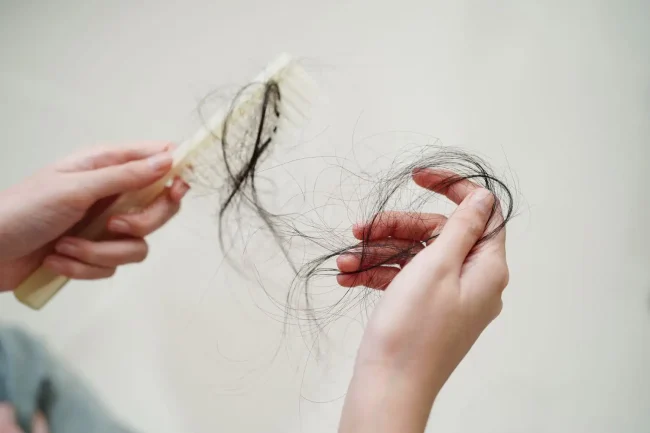 Tóc rụng nhiều có mọc lại được không? Sự thật từ chu kỳ mọc tóc