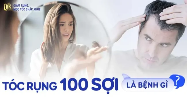 rụng tóc bao nhiêu sợi mỗi ngày là bình thường